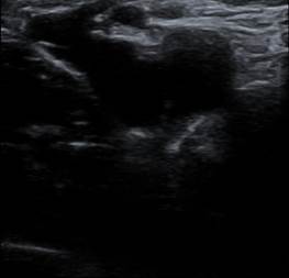 A close-up of a ultrasound
    
    Description automatically generated