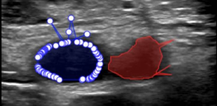 A ultrasound image of a baby

AI-generated content may be incorrect.