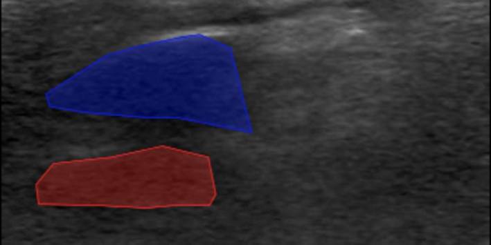 A close-up of a ultrasound

AI-generated content may be incorrect.