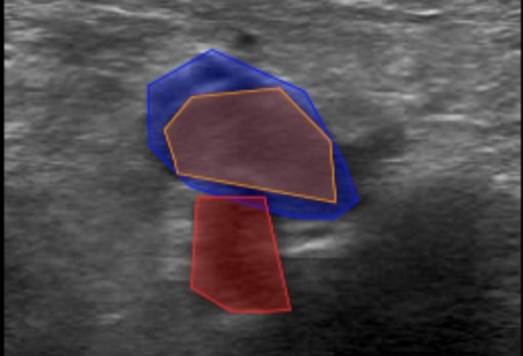 A close-up of a ultrasound

AI-generated content may be incorrect.